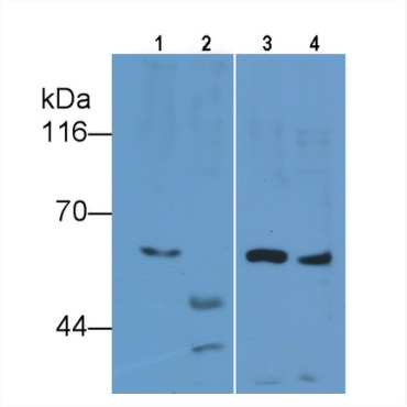 Interleukin 7 Receptor (IL7R) Human Monoclonal Antibody