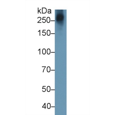 Aggrecan (AGC) Human Monoclonal Antibody