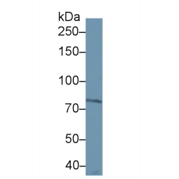 Apotransferrin (apoTf) Human Monoclonal Antibody