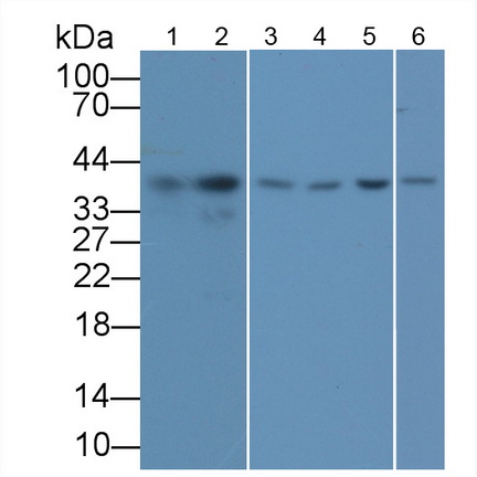 Glyceraldehyde-3-Phosphate Dehydrogenase (GAPDH) Human Monoclonal Antibody
