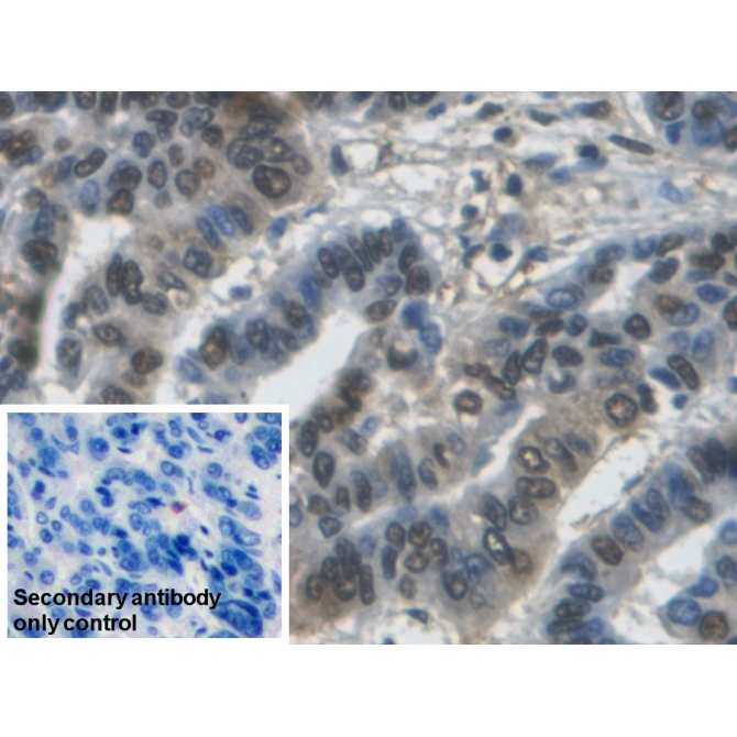 Glyceraldehyde-3-Phosphate Dehydrogenase (GAPDH) Human Monoclonal Antibody