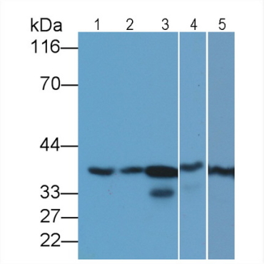Glyceraldehyde-3-Phosphate Dehydrogenase (GAPDH) Human Monoclonal Antibody