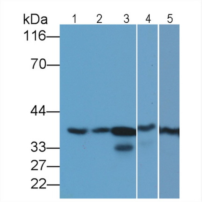 Glyceraldehyde-3-Phosphate Dehydrogenase (GAPDH) Human Monoclonal Antibody