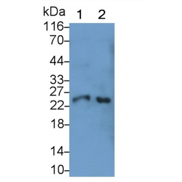 Cathepsin S (CTSS) Human Monoclonal Antibody