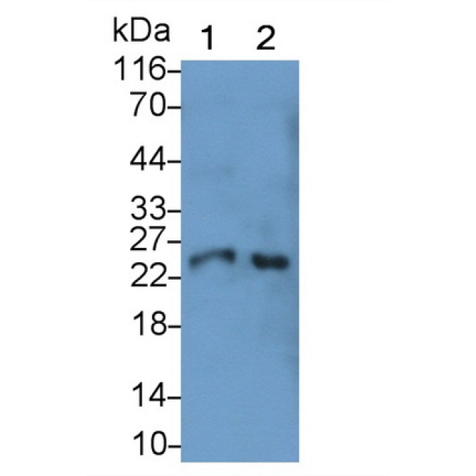 Cathepsin S (CTSS) Human Monoclonal Antibody