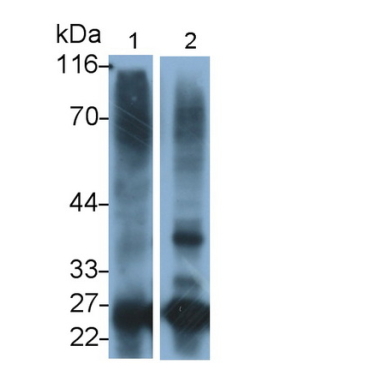 Cathepsin S (CTSS) Human Monoclonal Antibody