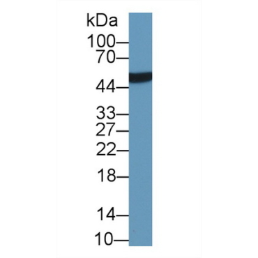 Leucine Rich Alpha-2-Glycoprotein 1 (LRG1) Human Monoclonal Antibody