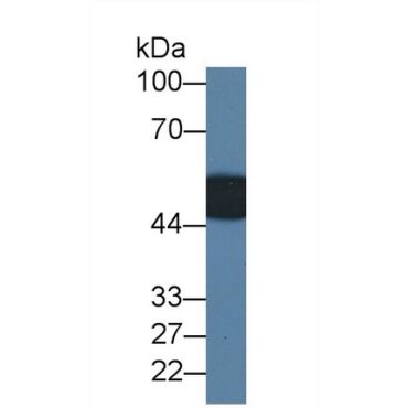 Leucine Rich Alpha-2-Glycoprotein 1 (LRG1) Human Monoclonal Antibody