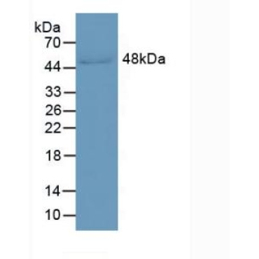 Leucine Rich Alpha-2-Glycoprotein 1 (LRG1) Human Monoclonal Antibody
