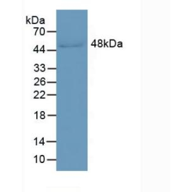 Leucine Rich Alpha-2-Glycoprotein 1 (LRG1) Human Monoclonal Antibody