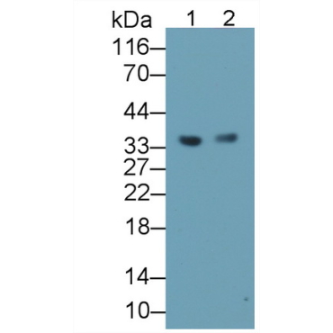 Leucine Rich Alpha-2-Glycoprotein 1 (LRG1) Human Monoclonal Antibody