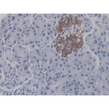 Leucine Rich Alpha-2-Glycoprotein 1 (LRG1) Human Monoclonal Antibody