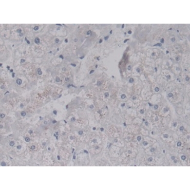 Leucine Rich Alpha-2-Glycoprotein 1 (LRG1) Human Monoclonal Antibody