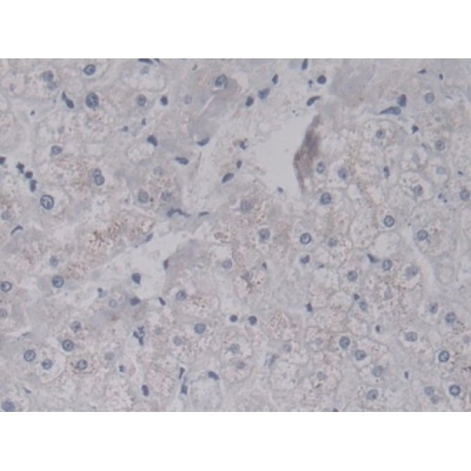 Leucine Rich Alpha-2-Glycoprotein 1 (LRG1) Human Monoclonal Antibody
