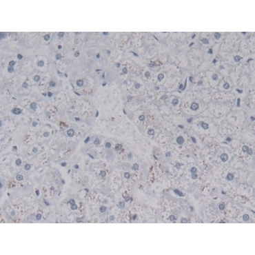 Leucine Rich Alpha-2-Glycoprotein 1 (LRG1) Human Monoclonal Antibody