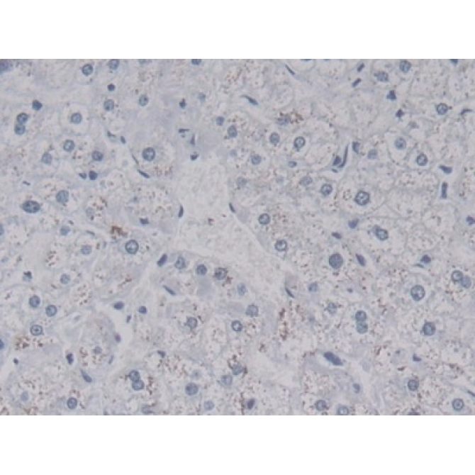Leucine Rich Alpha-2-Glycoprotein 1 (LRG1) Human Monoclonal Antibody