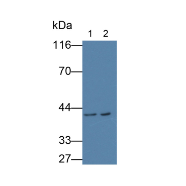 Annexin A2 (ANXA2) Human Monoclonal Antibody