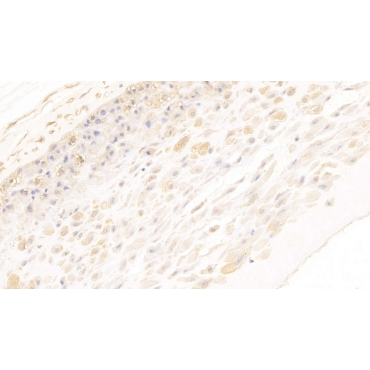 Annexin A2 (ANXA2) Human Monoclonal Antibody