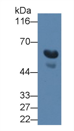 Transforming Growth Factor Beta 3 (TGFb3) Human Monoclonal Antibody