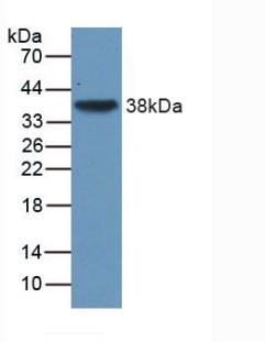 Transforming Growth Factor Beta 3 (TGFb3) Human Monoclonal Antibody