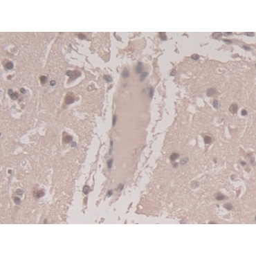 Transforming Growth Factor Beta 3 (TGFb3) Human Monoclonal Antibody