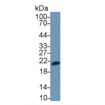 Interleukin 17F (IL17F) Human Monoclonal Antibody