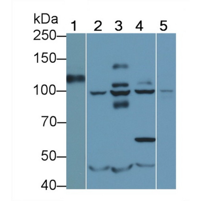 Cluster Of Differentiation 34 (CD34) Human Monoclonal Antibody