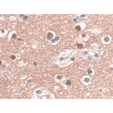 Cluster Of Differentiation 34 (CD34) Human Monoclonal Antibody