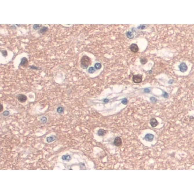 Cluster Of Differentiation 34 (CD34) Human Monoclonal Antibody