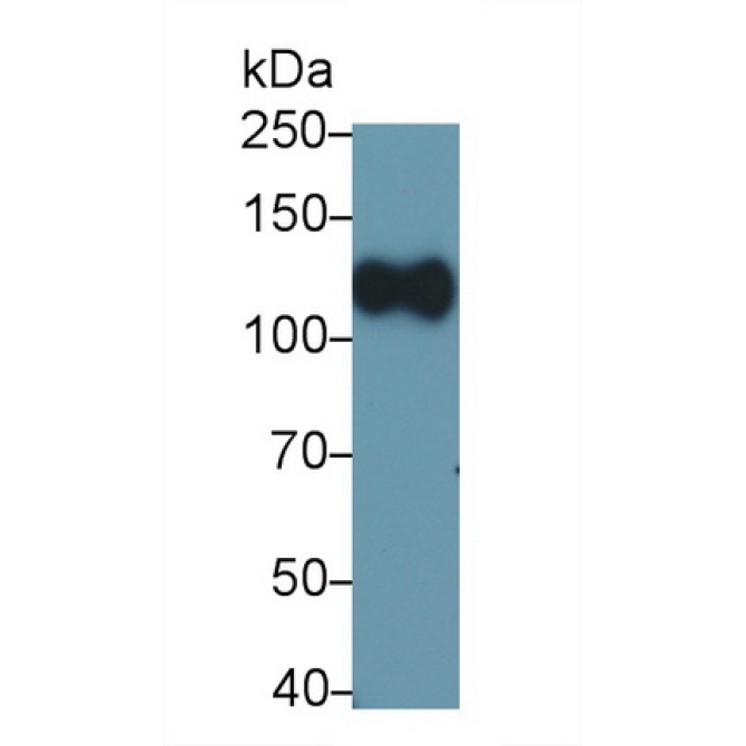 Cluster Of Differentiation 34 (CD34) Human Monoclonal Antibody