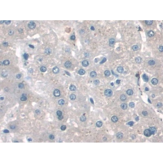Cluster Of Differentiation 34 (CD34) Human Monoclonal Antibody