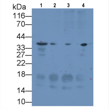 Syndecan 1 (SDC1) Human Monoclonal Antibody