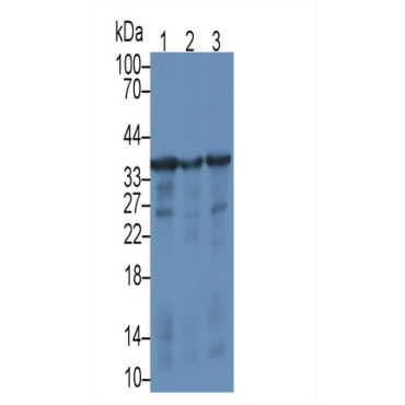 Syndecan 1 (SDC1) Human Monoclonal Antibody