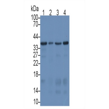 Syndecan 1 (SDC1) Human Monoclonal Antibody