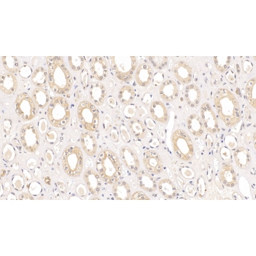 Syndecan 1 (SDC1) Human Monoclonal Antibody