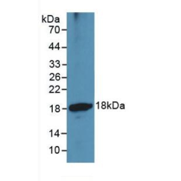 A Disintegrin And Metalloproteinase With Thrombospondin 1 (ADAMTS1) Human Monoclonal Antibody