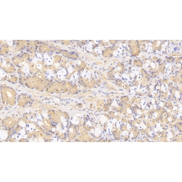 Tenascin C (TNC) Human Monoclonal Antibody