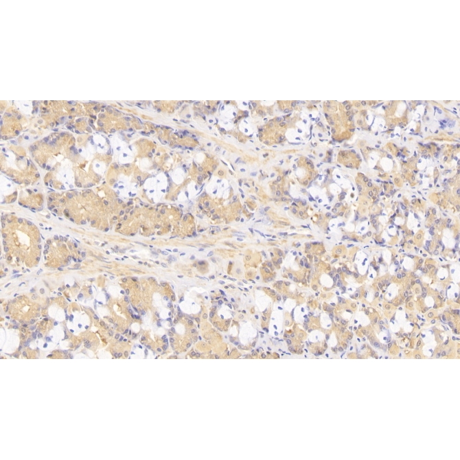 Tenascin C (TNC) Human Monoclonal Antibody