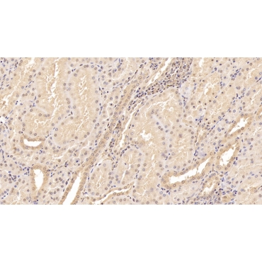 Tenascin C (TNC) Human Monoclonal Antibody