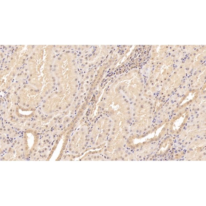Tenascin C (TNC) Human Monoclonal Antibody