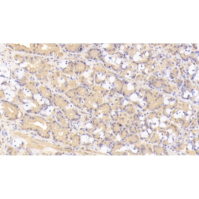Tenascin C (TNC) Human Monoclonal Antibody