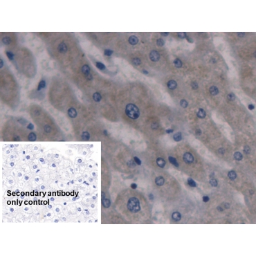 Hepcidin (Hepc) Human Monoclonal Antibody