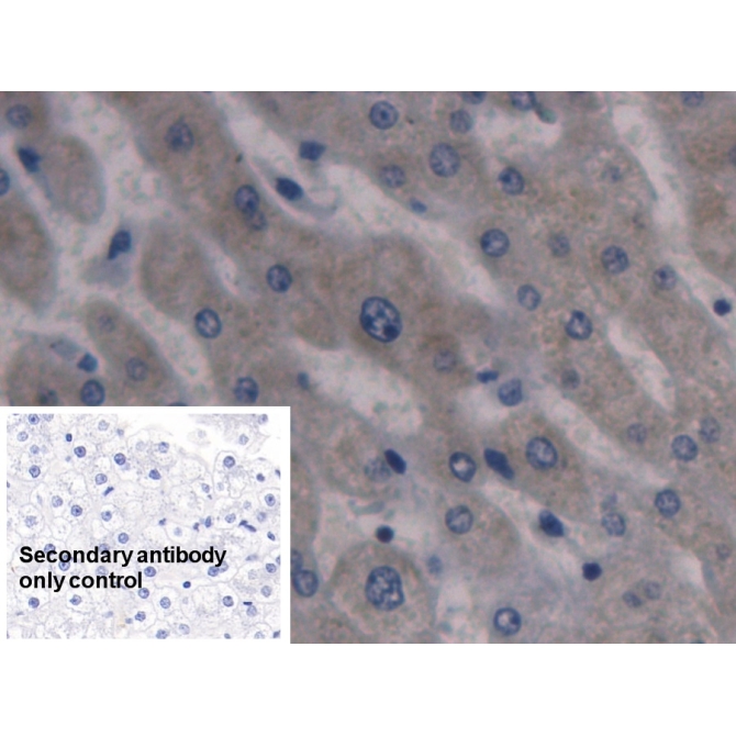 Hepcidin (Hepc) Human Monoclonal Antibody