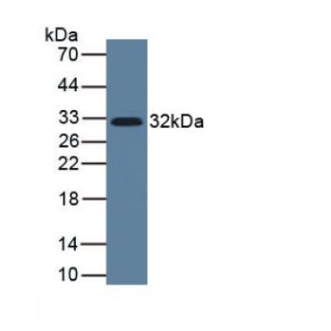 Interleukin 33 (IL33) Human Monoclonal Antibody