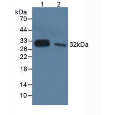 Interleukin 33 (IL33) Human Monoclonal Antibody