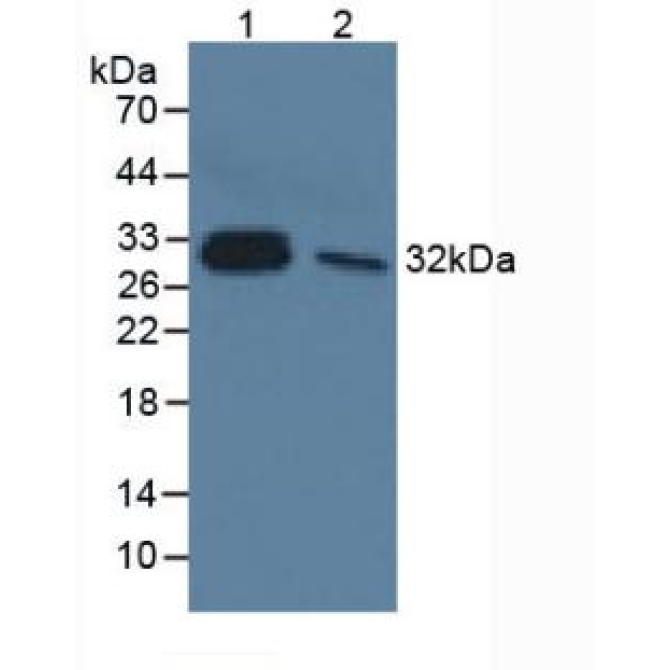 Interleukin 33 (IL33) Human Monoclonal Antibody