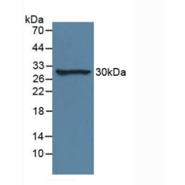 Interleukin 33 (IL33) Human Monoclonal Antibody