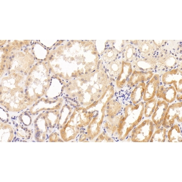 Tau Protein (MAPT) Human Monoclonal Antibody