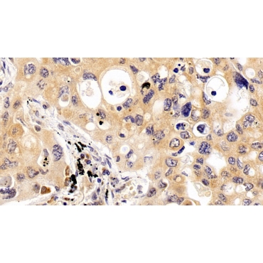 Tau Protein (MAPT) Human Monoclonal Antibody