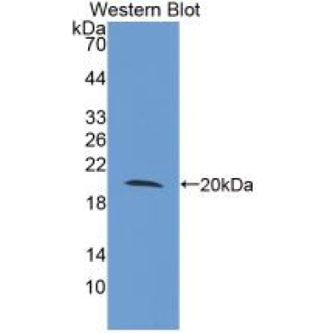 Toll Like Receptor 3 (TLR3) Human Monoclonal Antibody